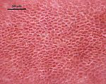 4 - Cellule corticali in visione superficiale